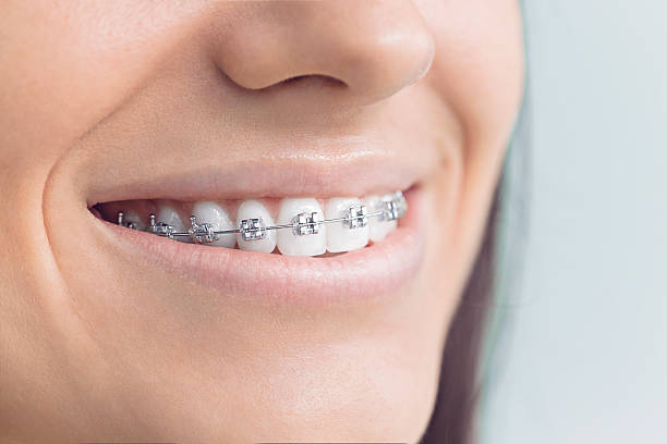 Trusted Milton, LA Dental Services Experts